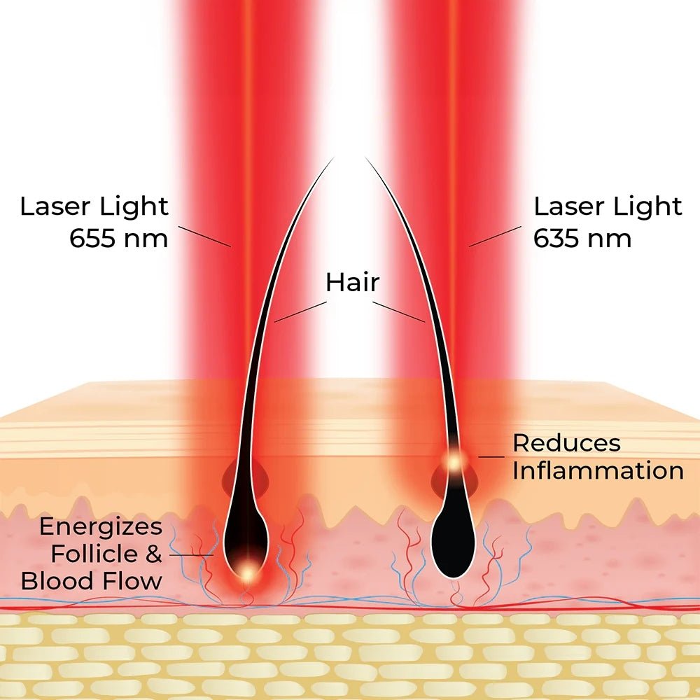 Hairmax Actonis™ 18 Dual Action Hair Growth LaserComb - Beauty Tribe