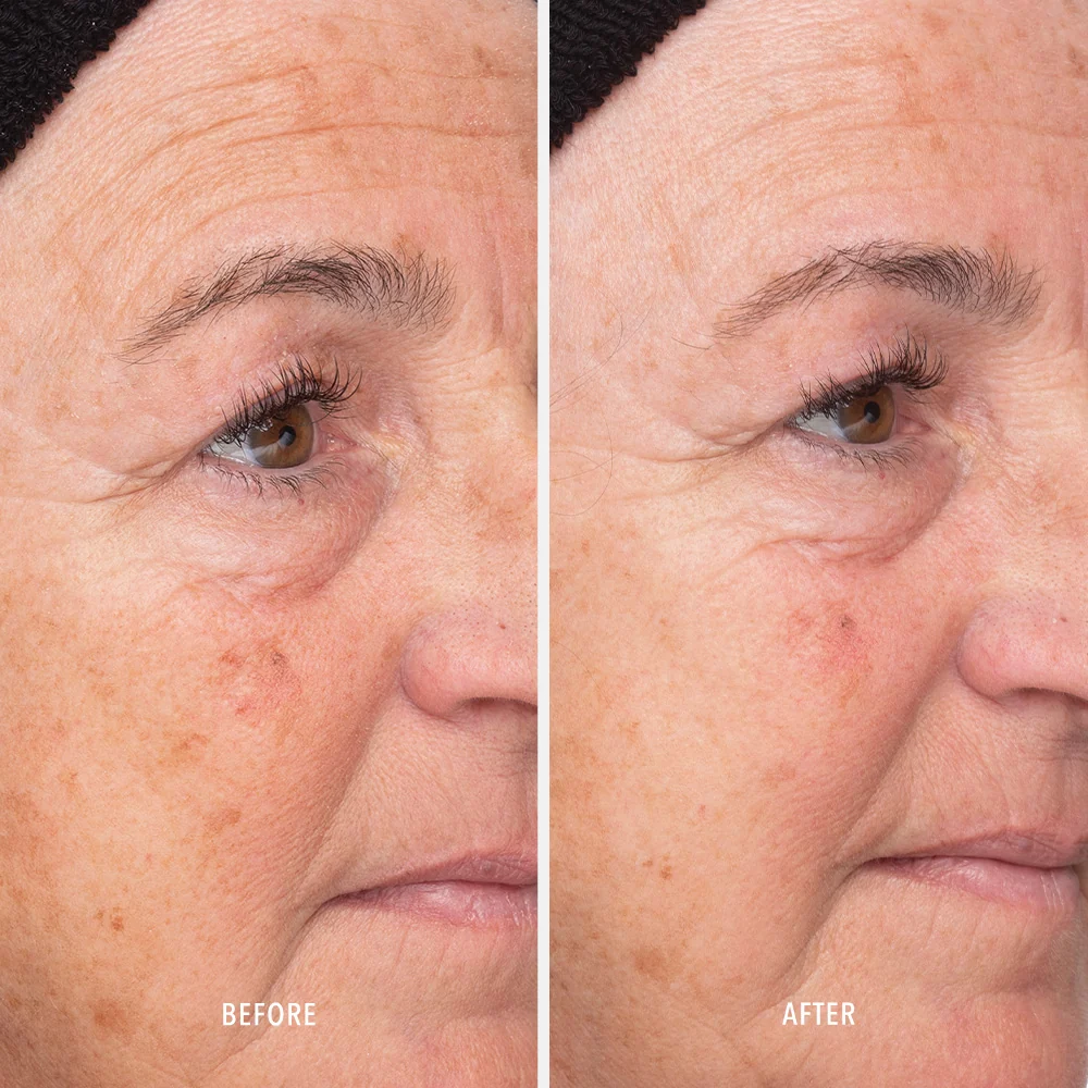 Hydropeptide Liquid Resurfacing Solution 120ml