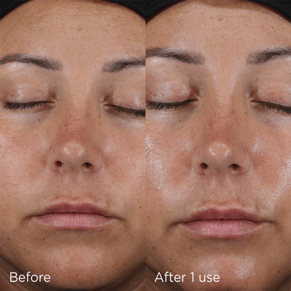 Image Skincare Daily Prevention Ultra Defense Moisturizer SPF 50 73g - Beauty Tribe