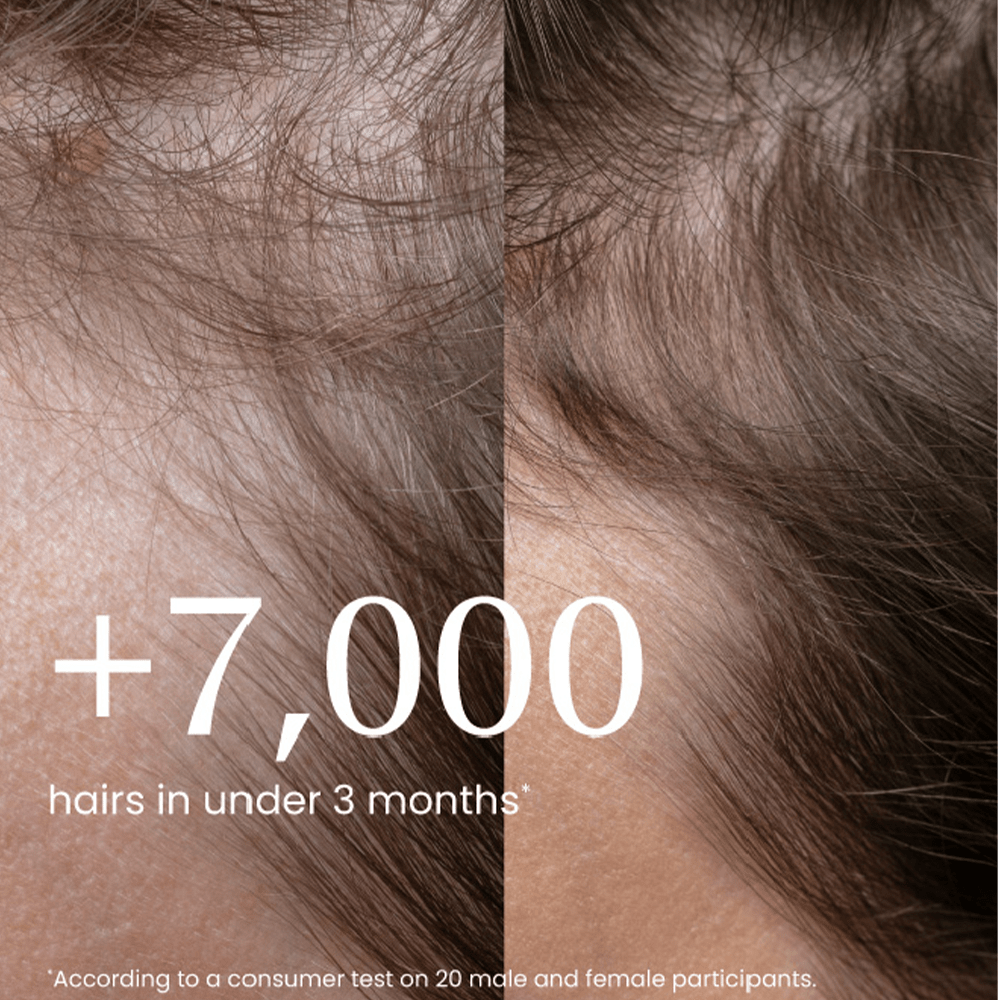 Izil Beauty Densify Strengthening Hair Ampoules 12x9ml - Beauty Tribe