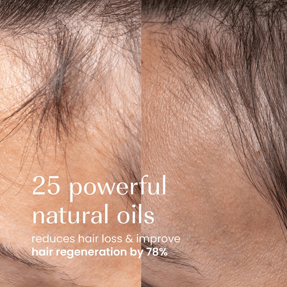 Izil Beauty Densify Strengthening Hair Oil 190ml - Beauty Tribe