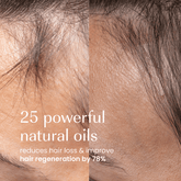 Izil Beauty Densify Strengthening Hair Oil 190ml - Beauty Tribe