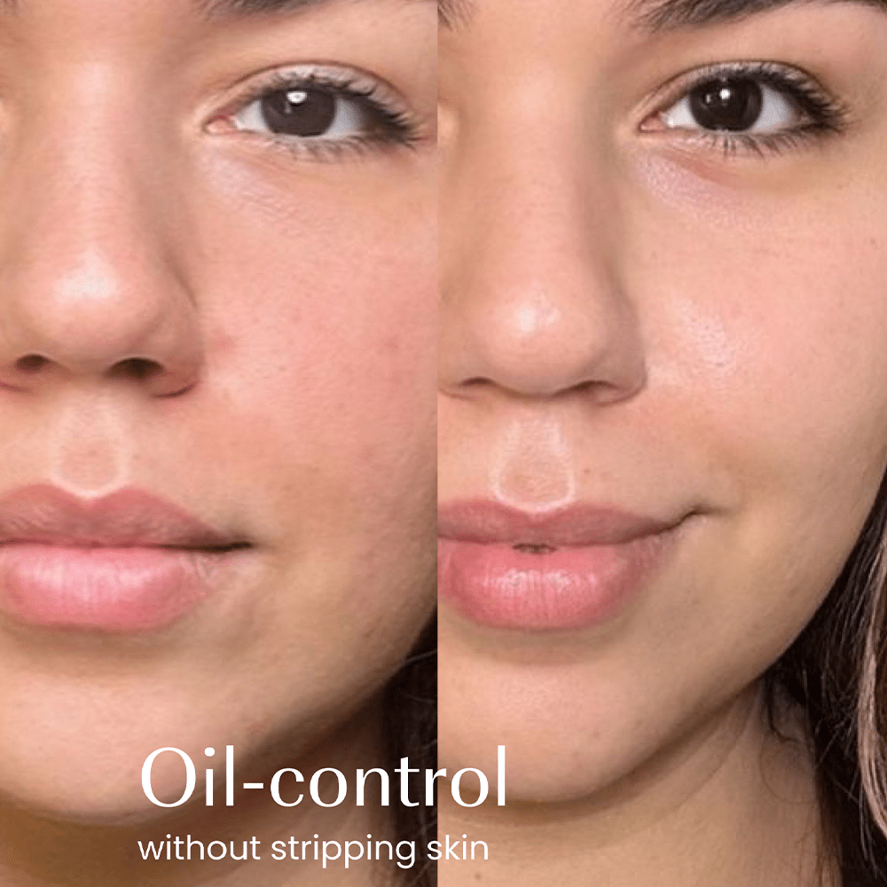 Izil Beauty Green Tea Oil Control Gel Cleanser 150ml - Beauty Tribe