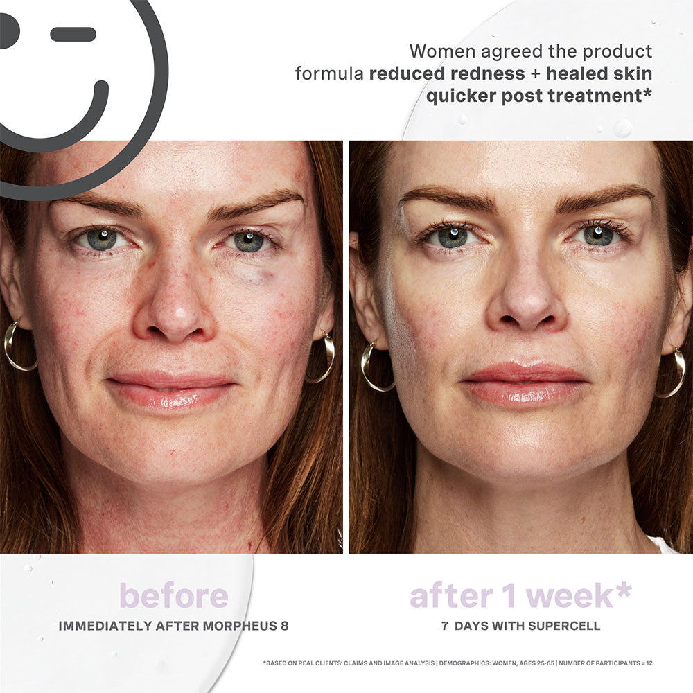 Kate Somerville Kateceuticals Supercell Rejuvenation Serum - 1oz/30