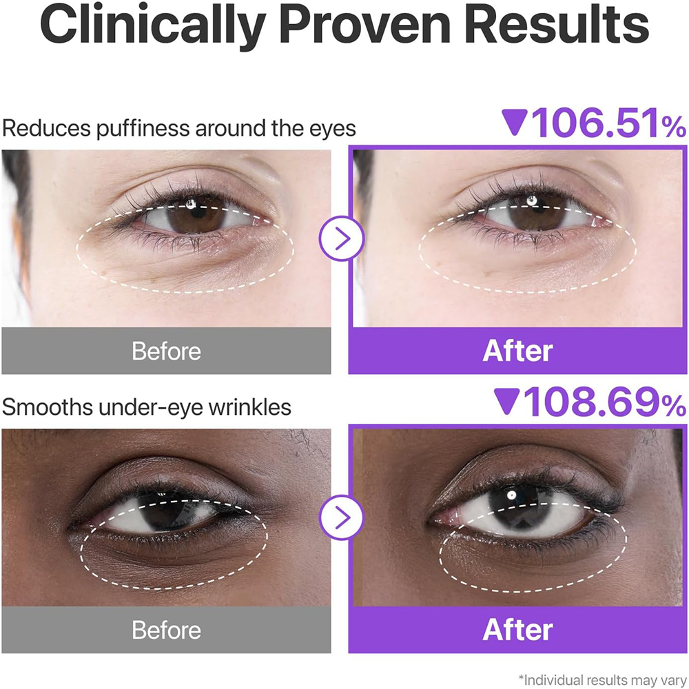 Numbuzin No.9 NAD+ Collagen Under Eye Patches (8g *5ea)