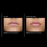 PCA Hyaluronic Acid Lip Booster 6g - Beauty Tribe