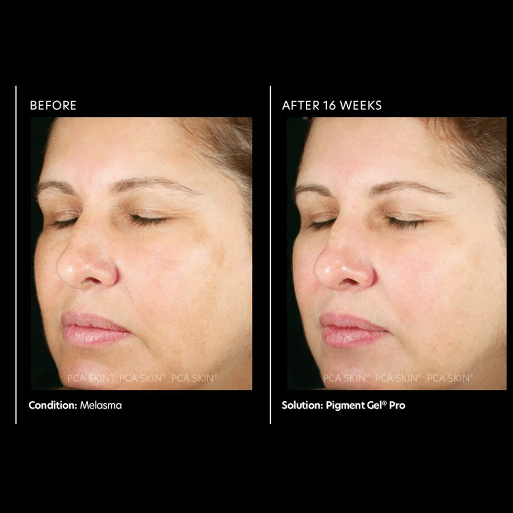 PCA Pigment Gel® Pro 29ml - Beauty Tribe