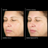 PCA Pigment Gel® Pro 29ml - Beauty Tribe