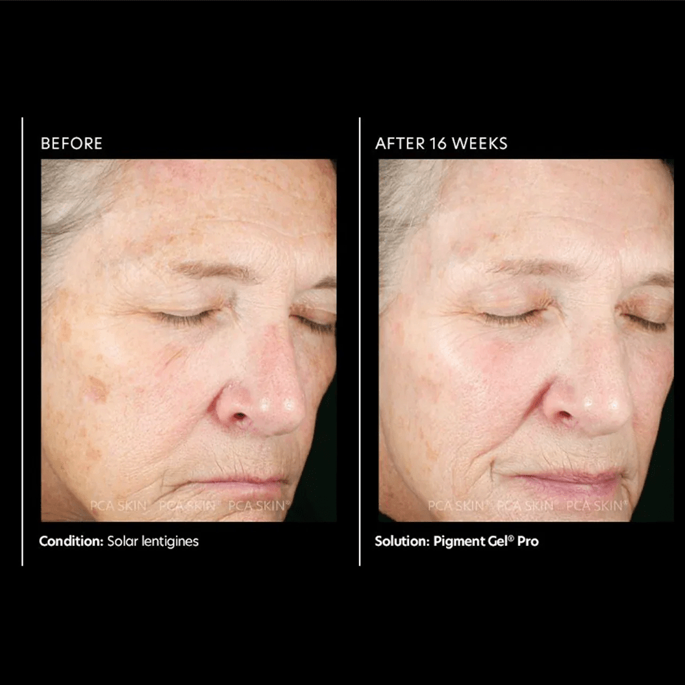 PCA Pigment Gel® Pro 29ml - Beauty Tribe