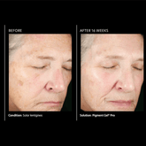 PCA Pigment Gel® Pro 29ml - Beauty Tribe