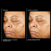 PCA Pigment Gel® Pro 29ml - Beauty Tribe