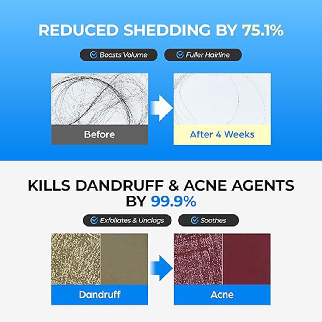 Seapuri Scalpy Bubble Hair Growth Tonic 100ml - Beauty Tribe