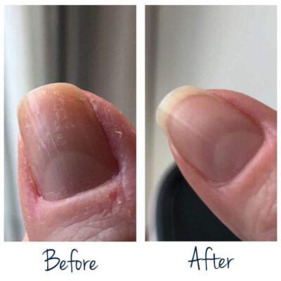 Herome Exit Damaged Nails Rescue Oil