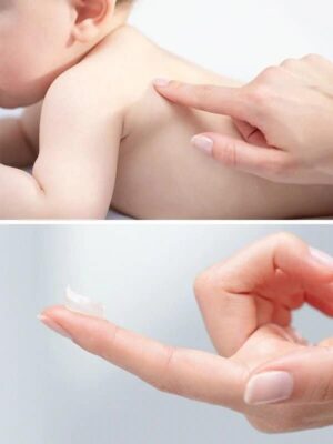 baby-sensitive-skin