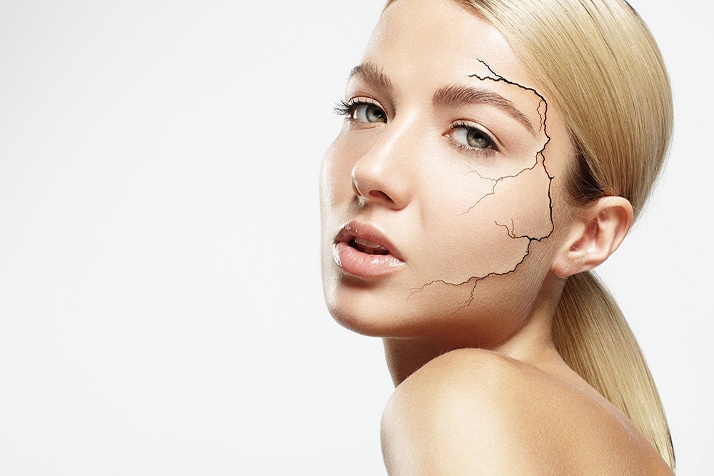 How Can You Treat Dry Skin