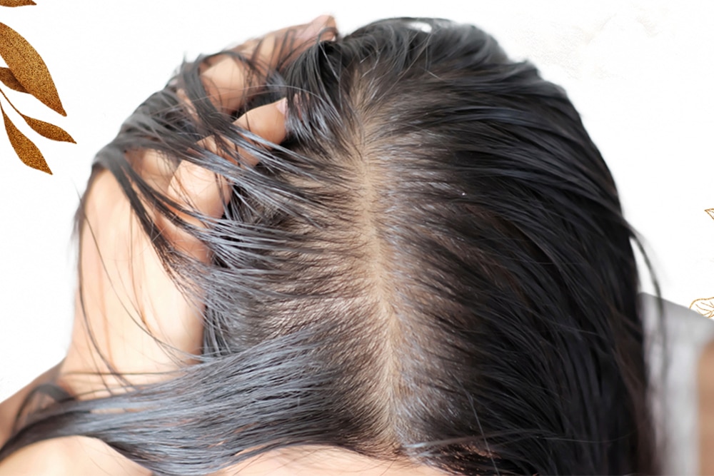 Oily Hair No More - Top 5 Products