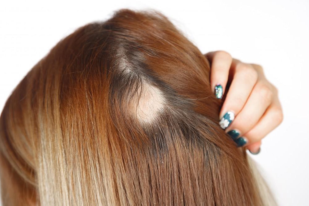 ما هي المنتجات لاستخدامها في علاج تساقط الشعر
