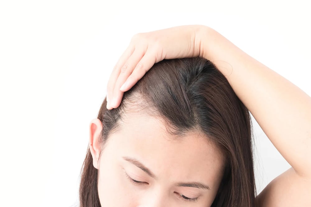What Are The Causes, Symptoms, And Treatments For Hair loss
