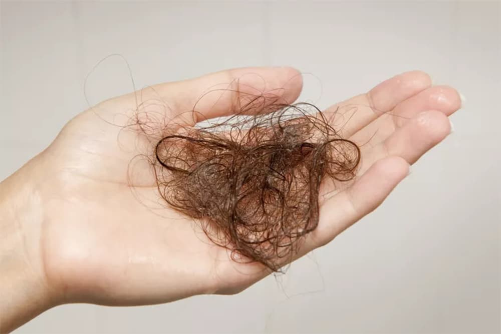 أهم 10 نصائح وحيل لأي شخص يعاني من تساقط الشعر